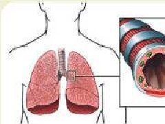急性支气管炎的症状临床表现_中医急性支气管炎怎么办治疗